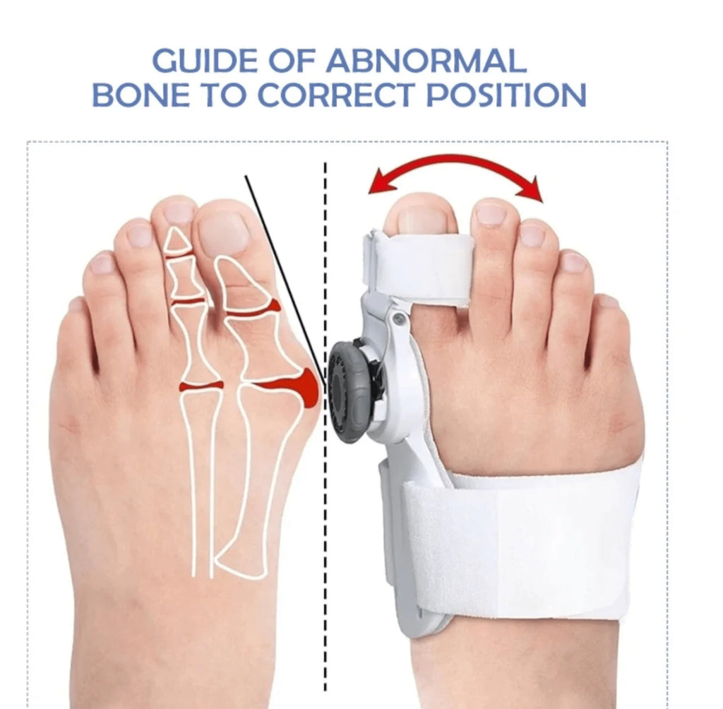 Ispravljač Korektor za Nožne Prste