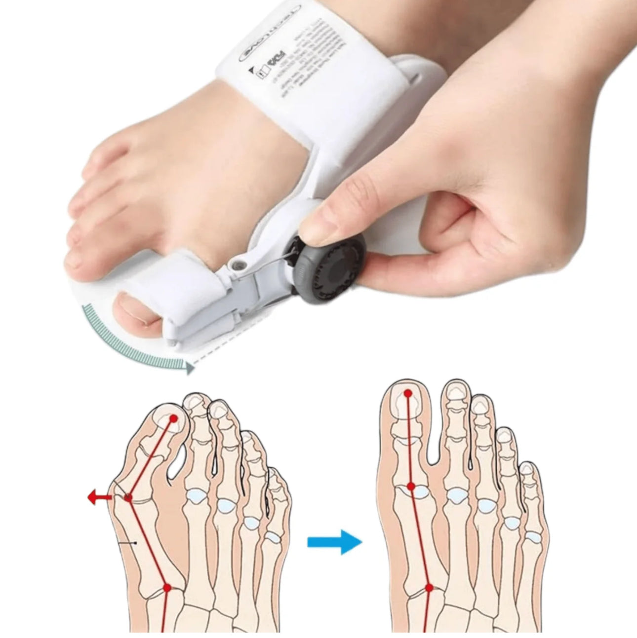 Ispravljač Korektor za Nožne Prste