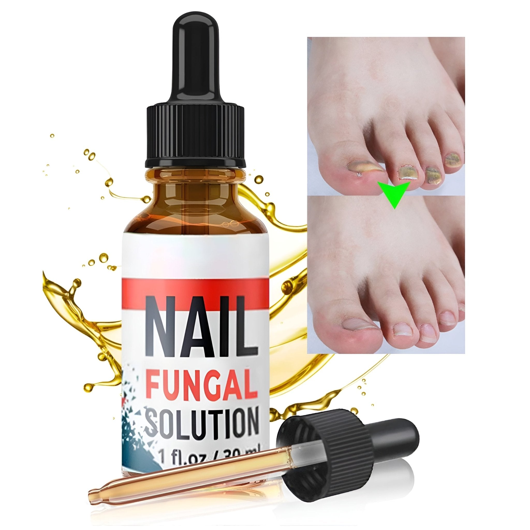 Antigljivični Serum za Nokte 3+1 GRATIS