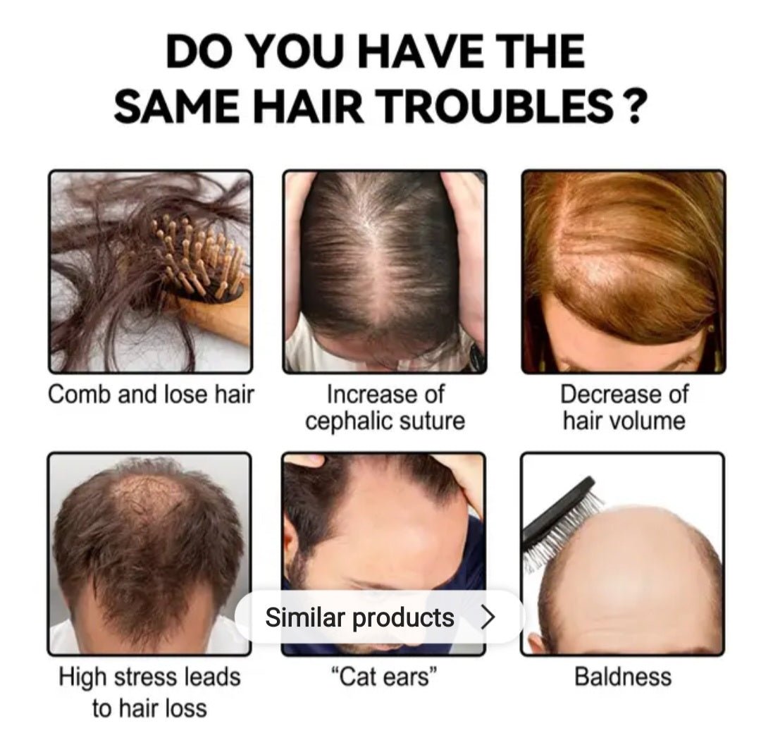 Đumbir prah za rast kose 3+1 GRATIS