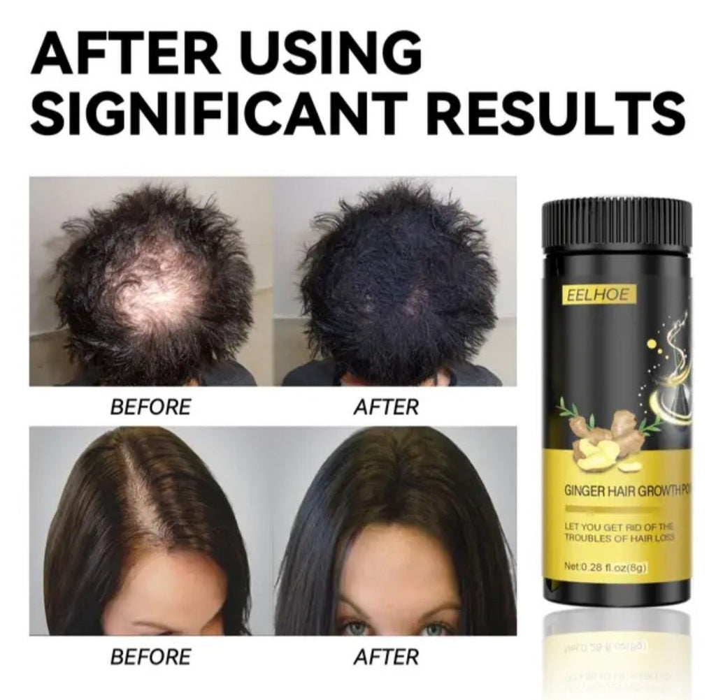 Đumbir prah za rast kose 3+1 GRATIS