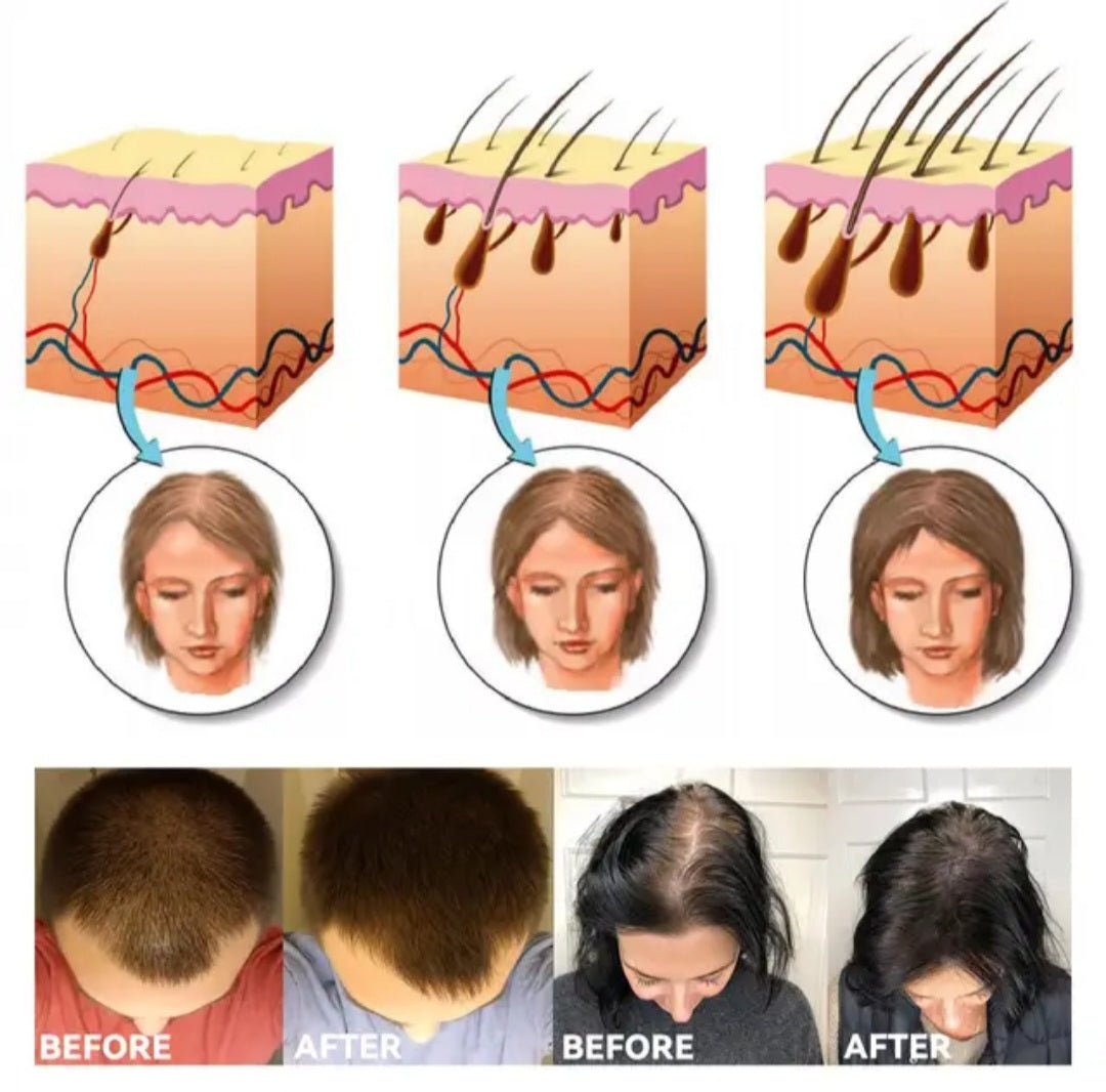 Đumbir prah za rast kose 3+1 GRATIS