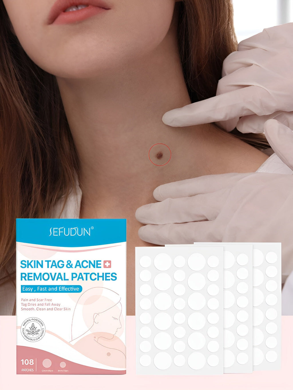 Flasteri za uklanjanje bradavica 3+1 GRATIS