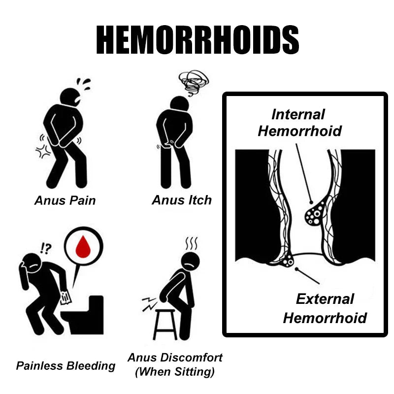HuaTuo Krema za Hemoroide 3+1 GRATIS