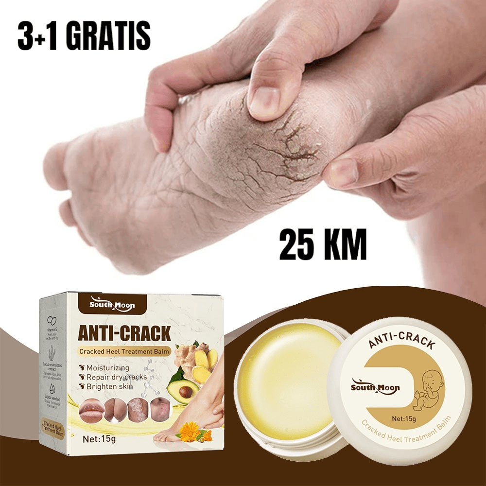 Krema za Ispucale Pete