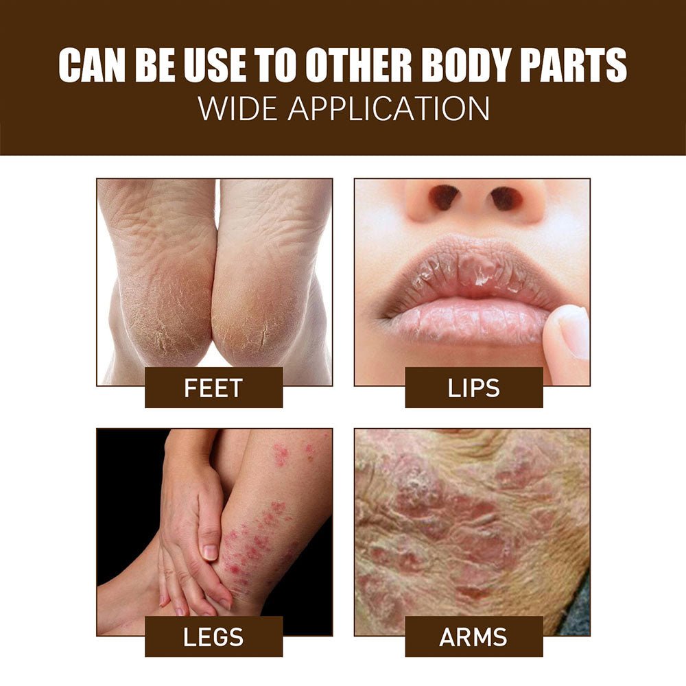 Krema za Ispucale Pete